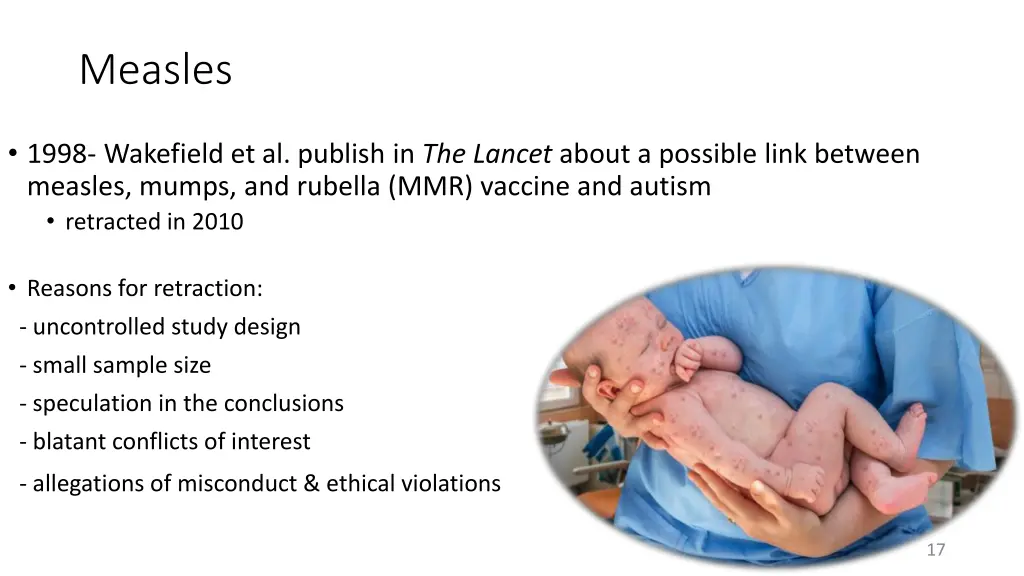 measles 1