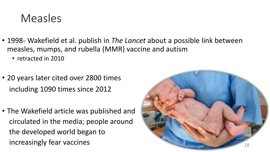 measles 2