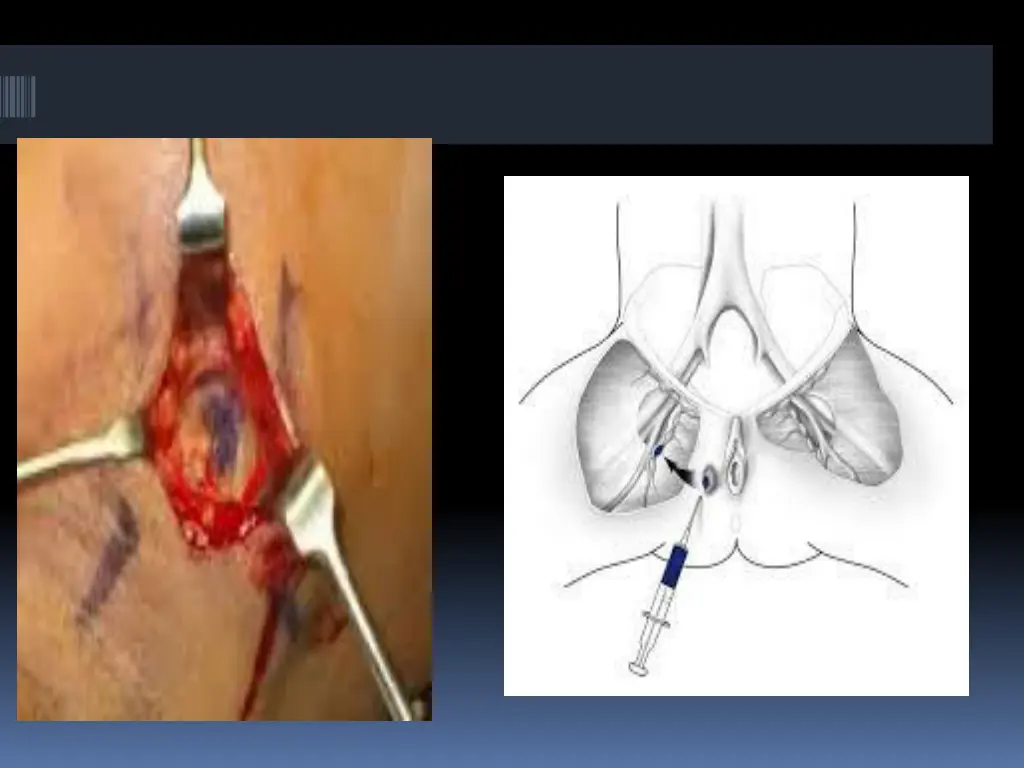 slide23
