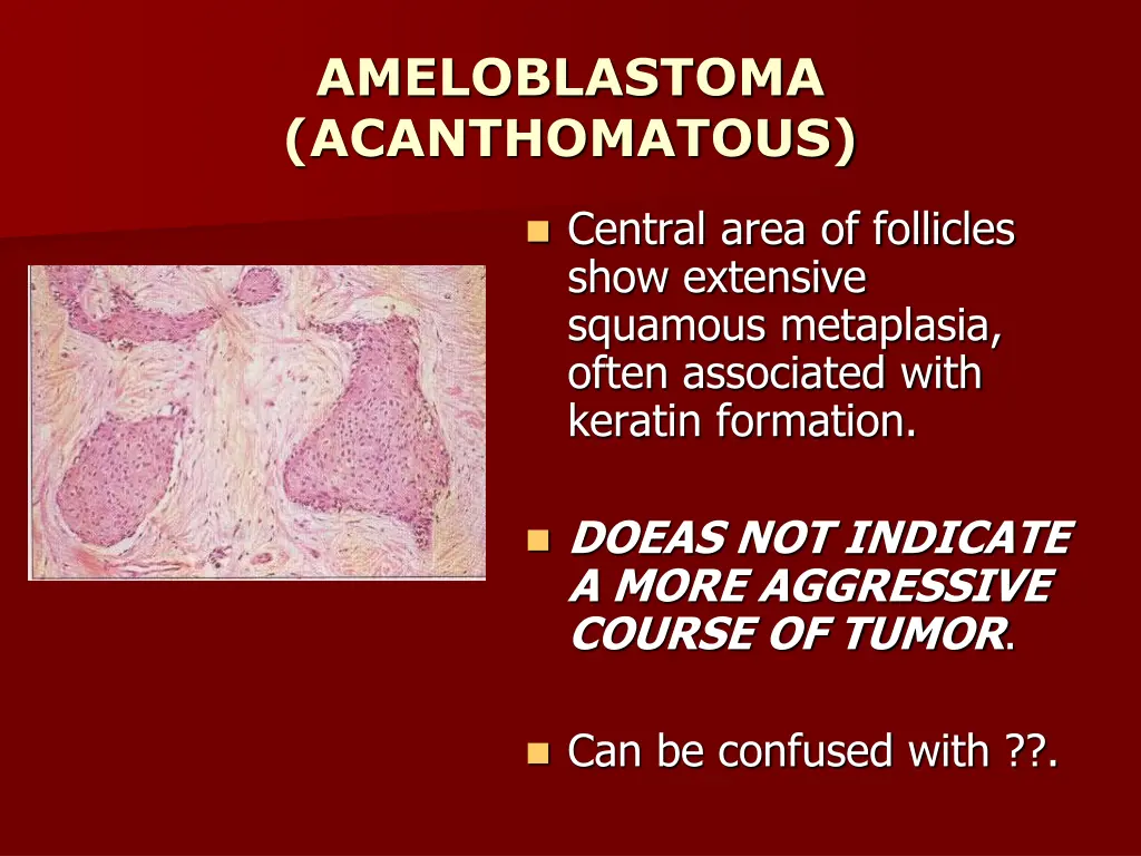 ameloblastoma acanthomatous