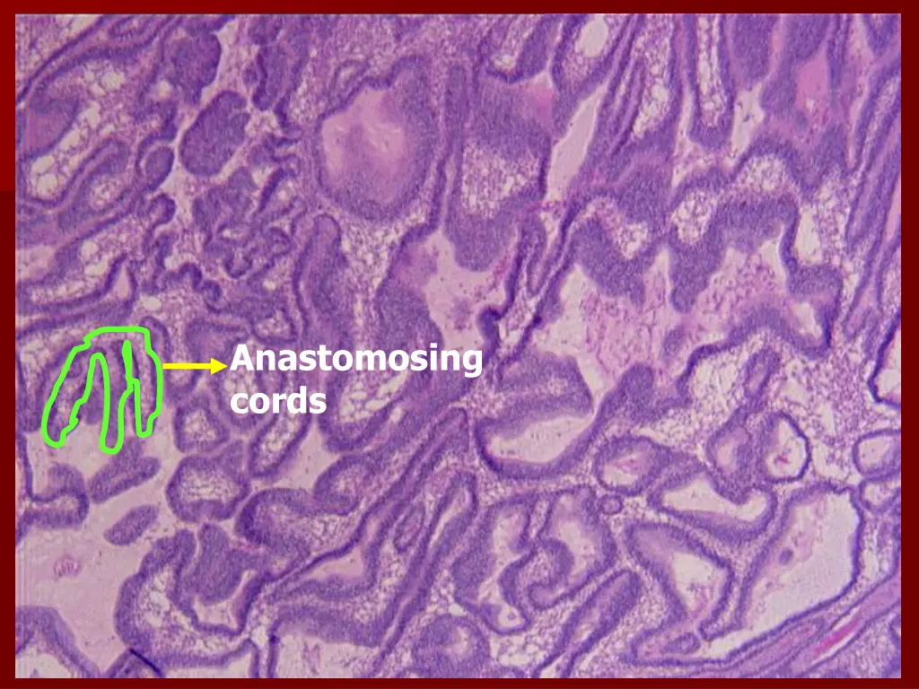 anastomosing cords