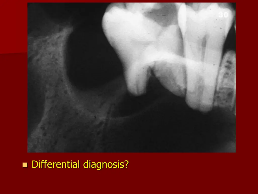 differential diagnosis 1