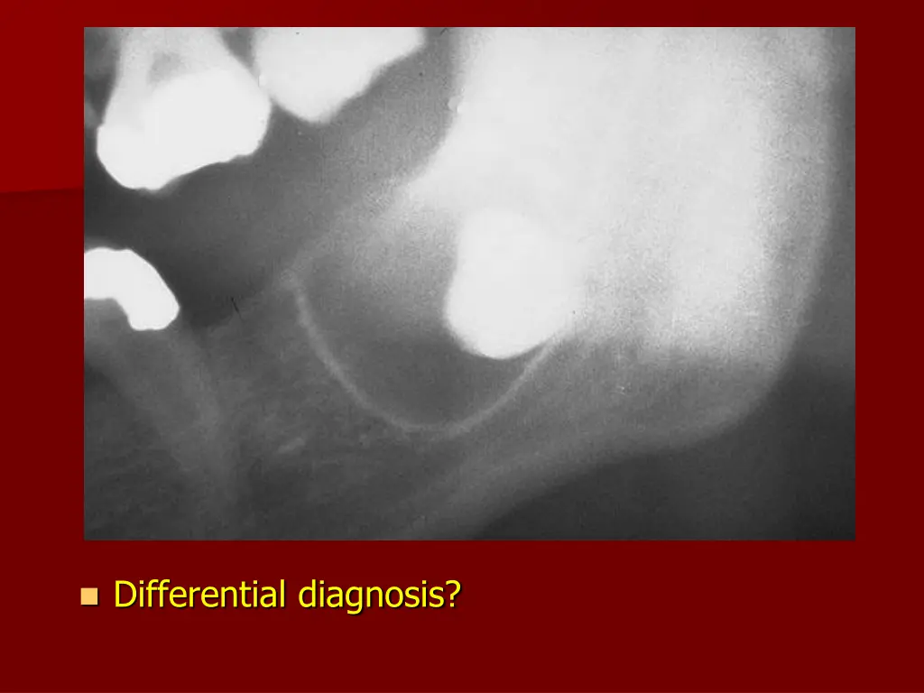 differential diagnosis