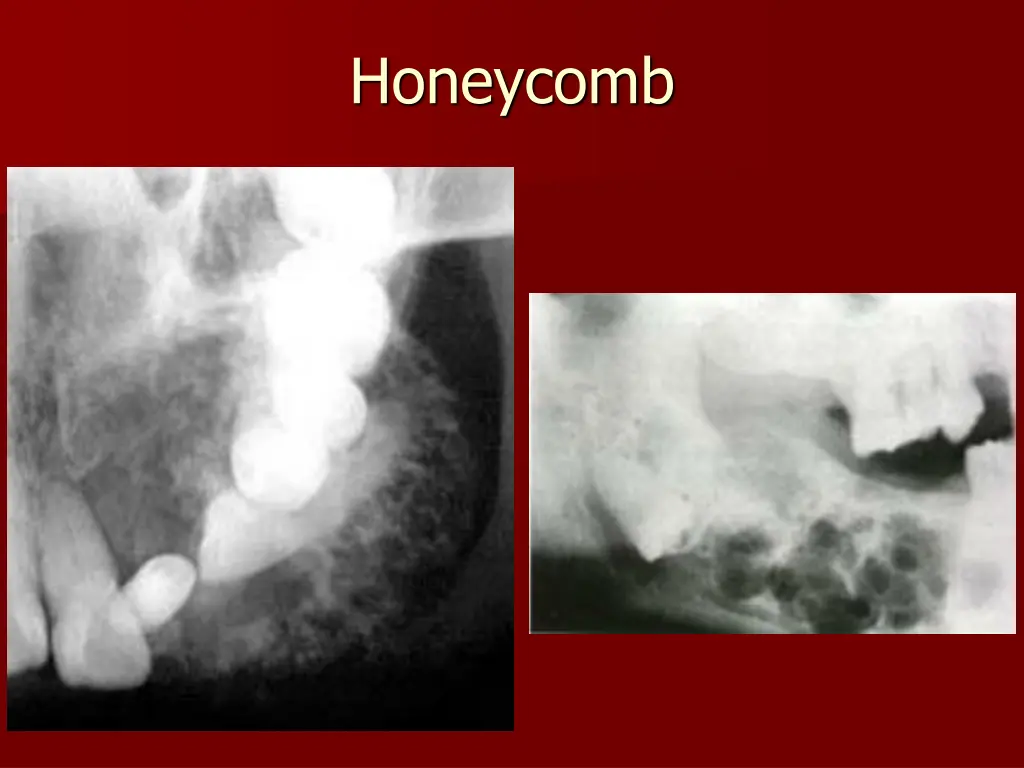 honeycomb