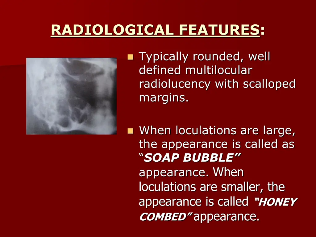 radiological features