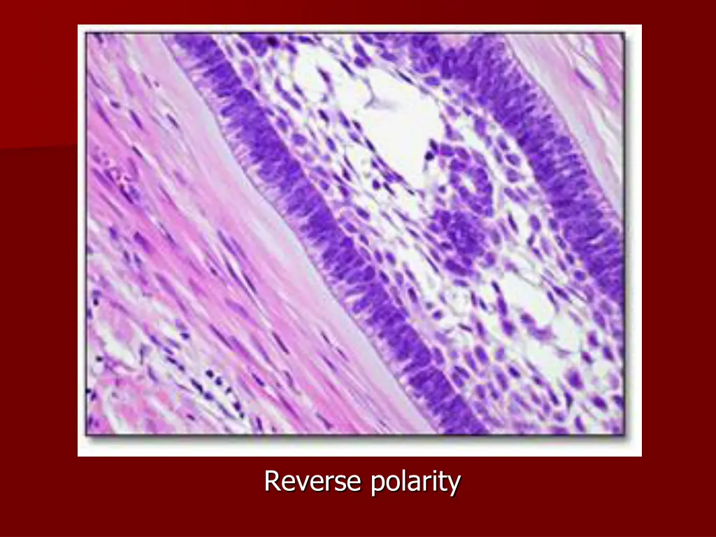 reverse polarity