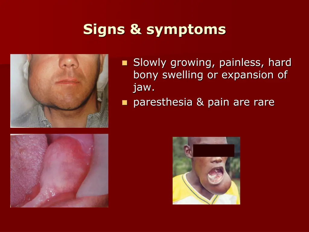 signs symptoms