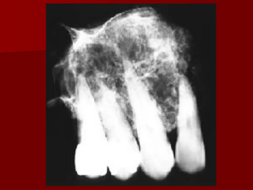 slide21