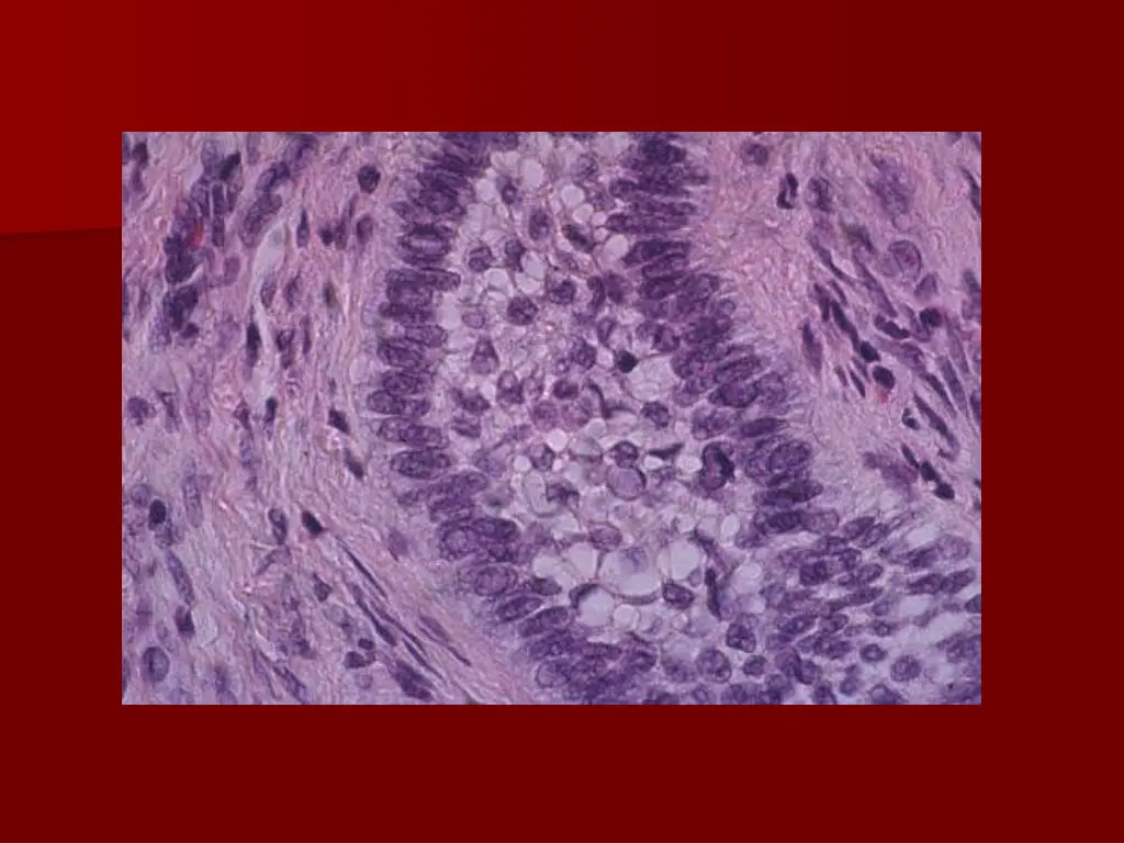 slide25