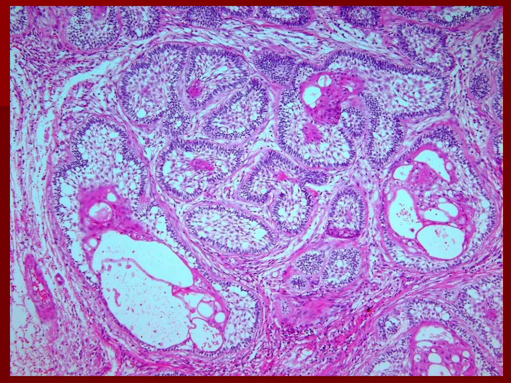 slide32