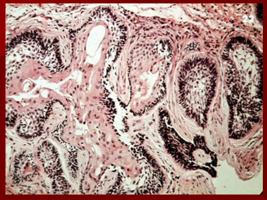 slide33