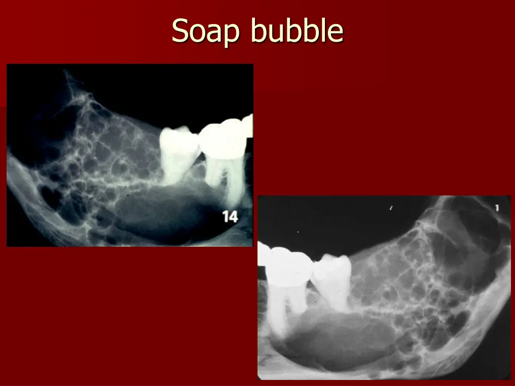 soap bubble