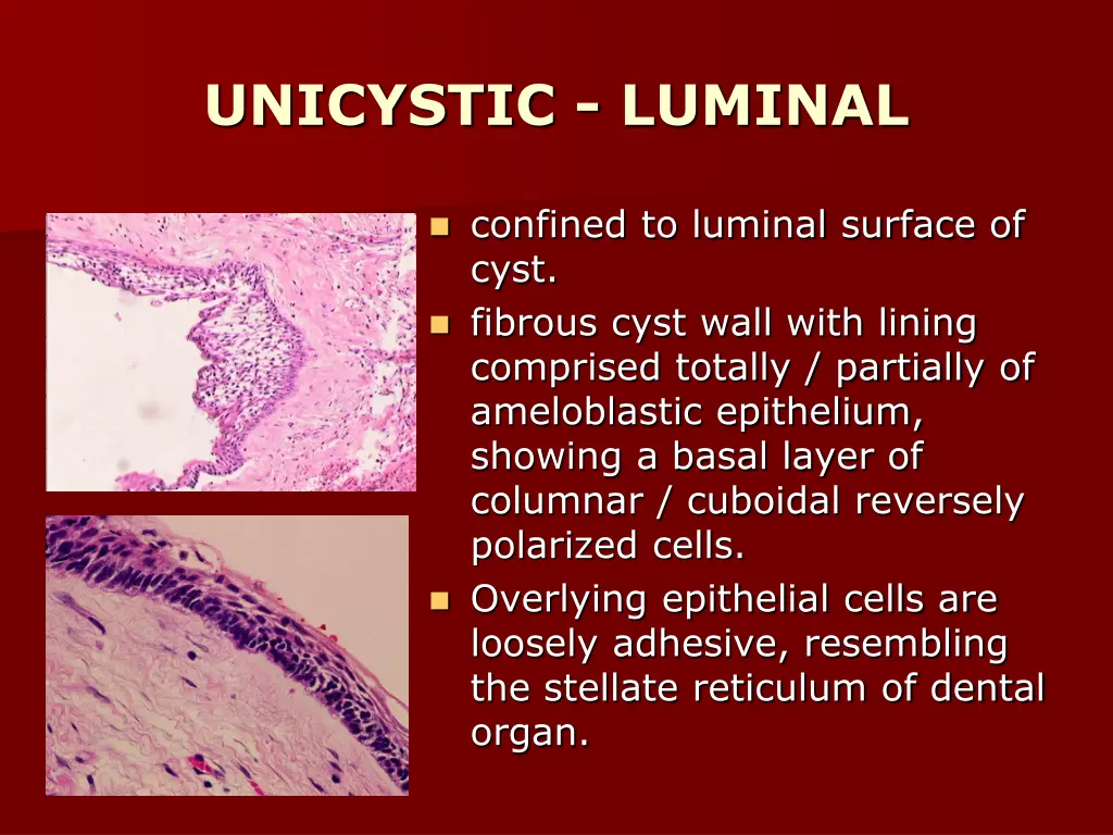 unicystic luminal