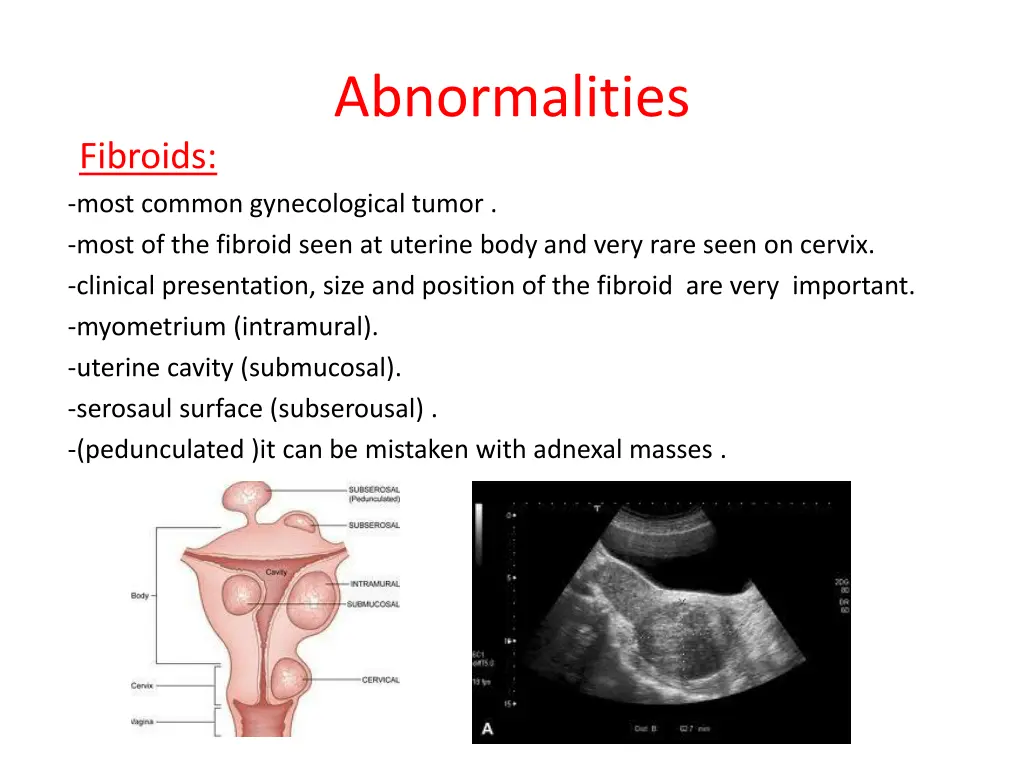 abnormalities