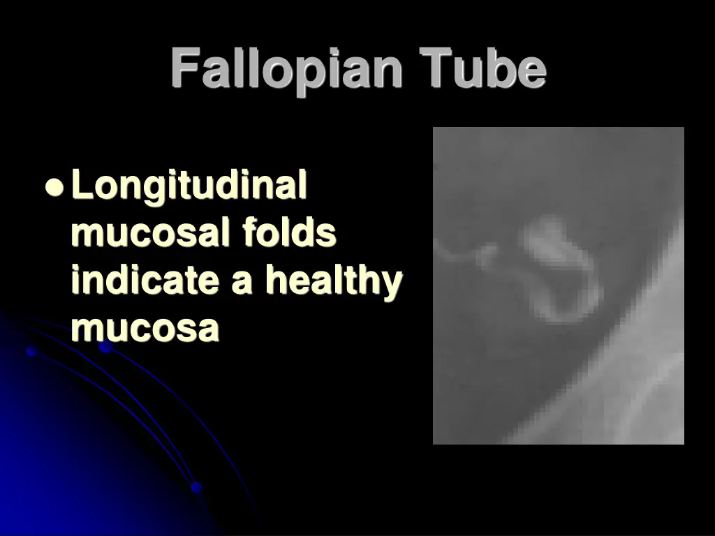 fallopian tube 1