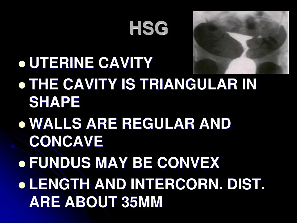 slide23