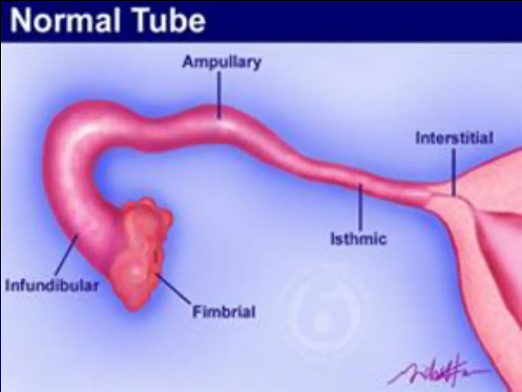 slide25