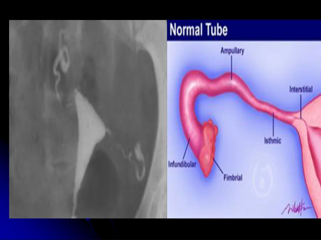 slide28