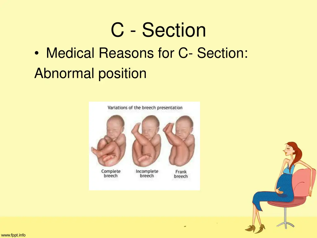 c section