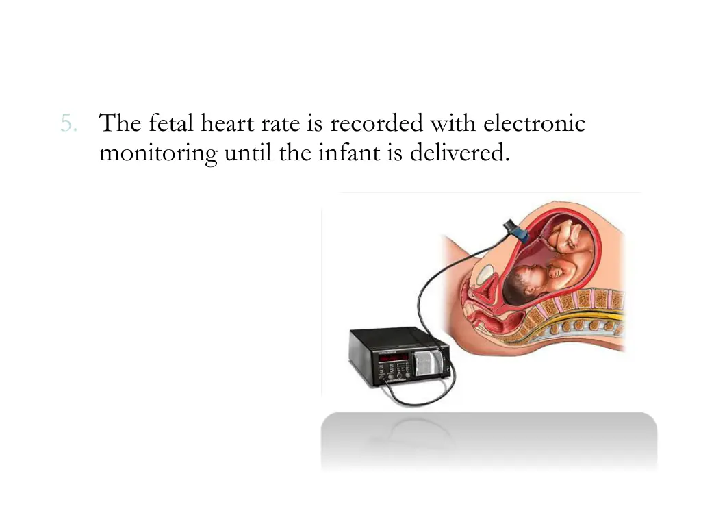 5 the fetal heart rate is recorded with