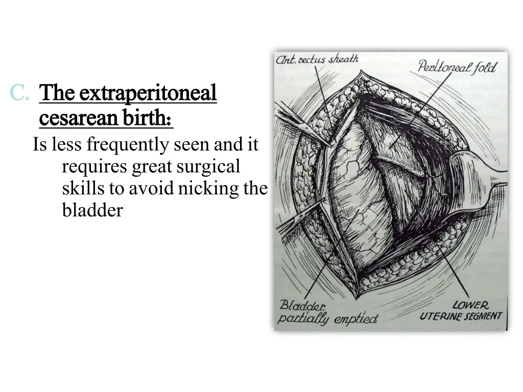 c c the the extraperitoneal extraperitoneal
