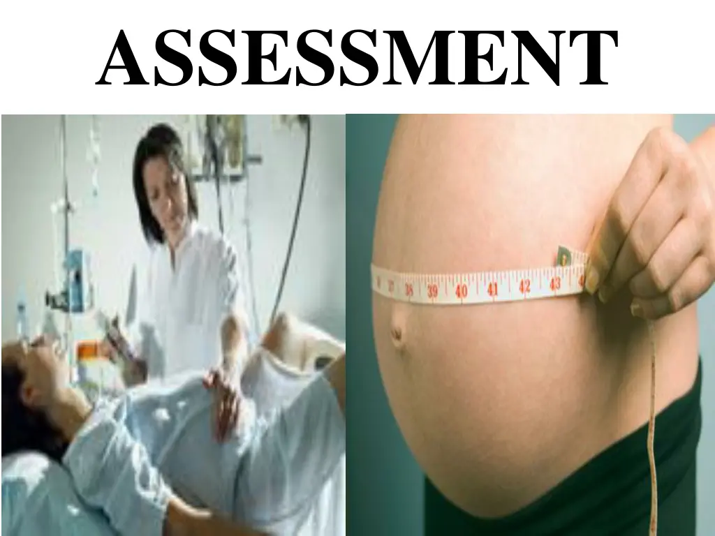 assessment