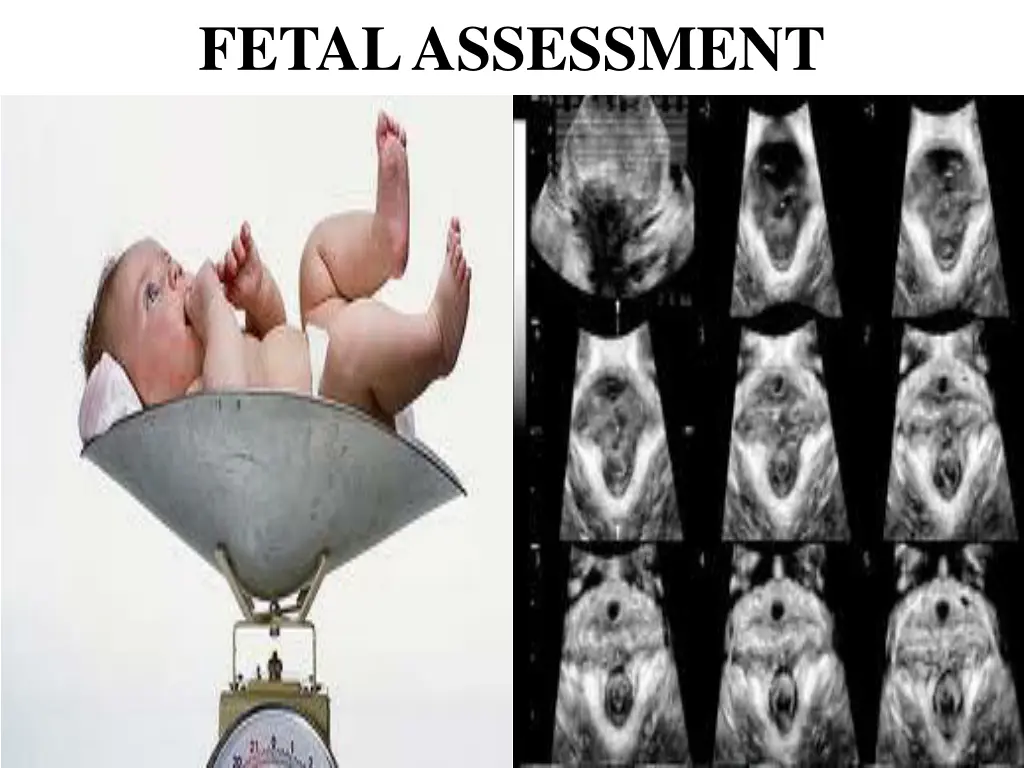 fetal assessment
