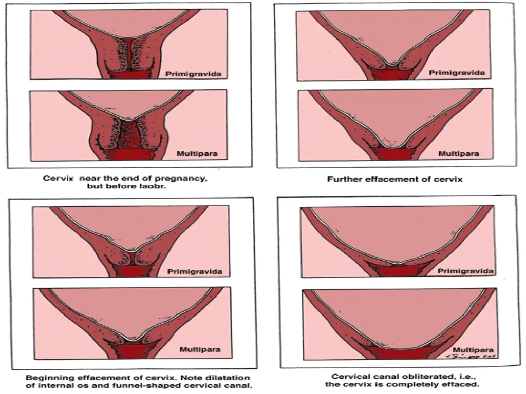 slide12