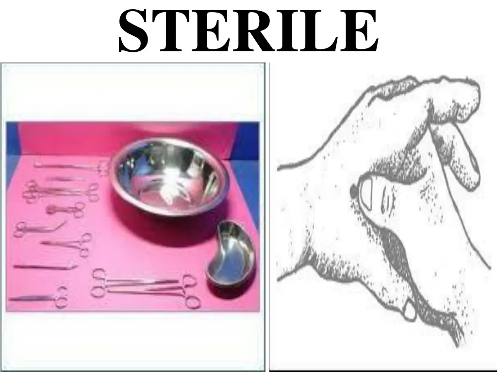 sterile