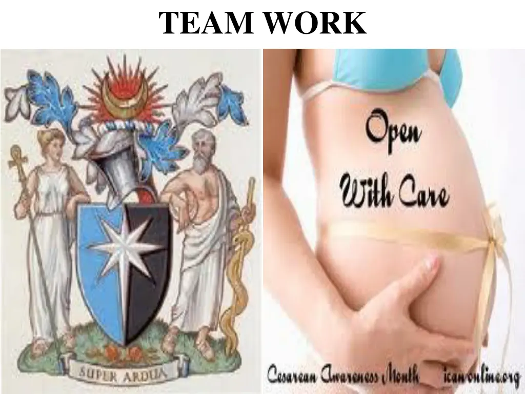 team work
