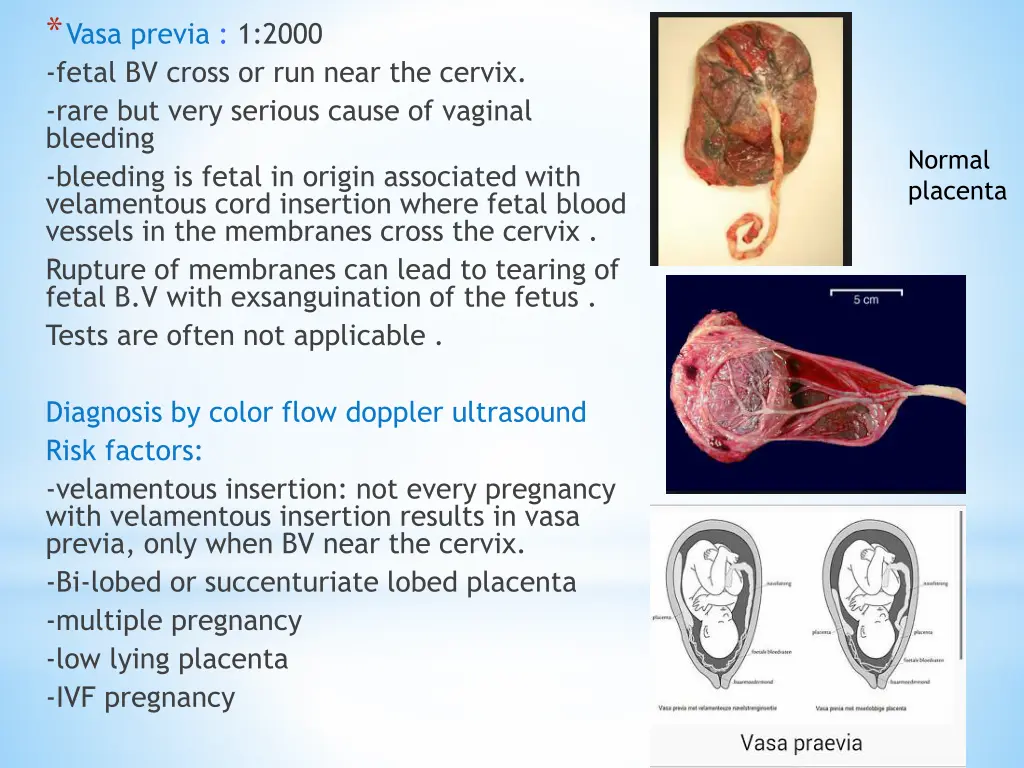 vasa previa 1 2000 fetal bv cross or run near