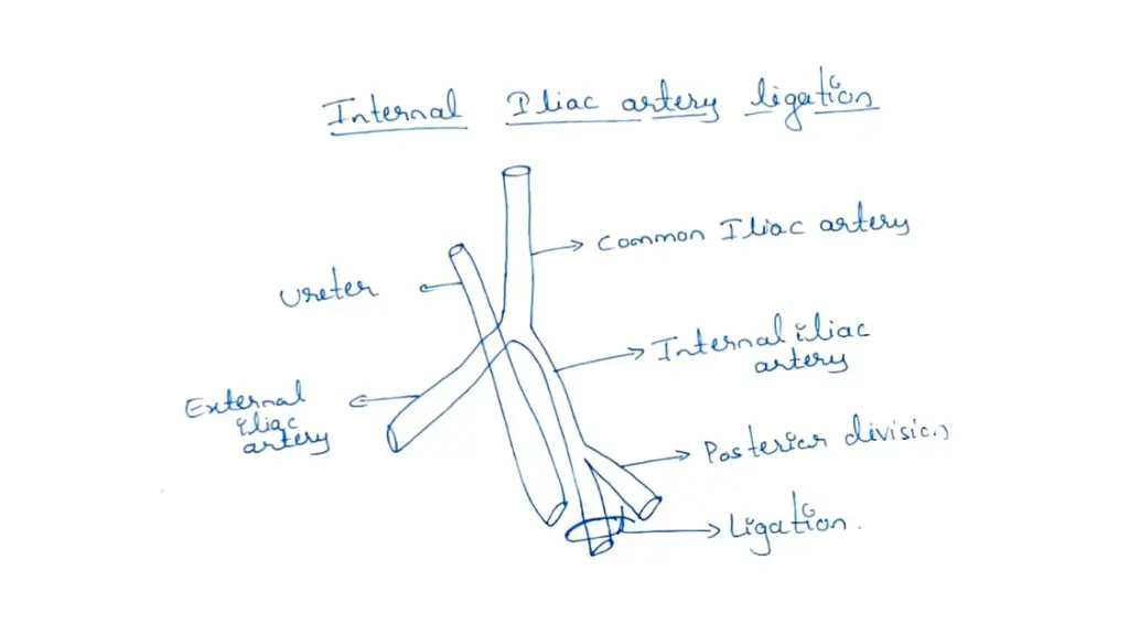 slide10