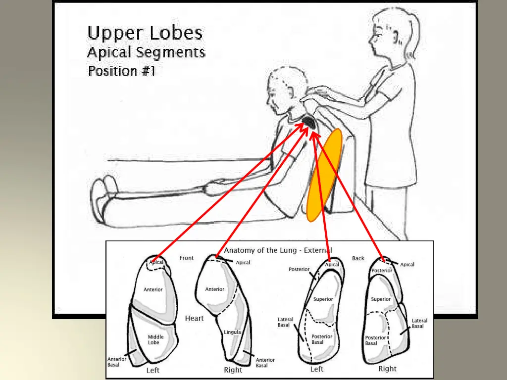 slide10