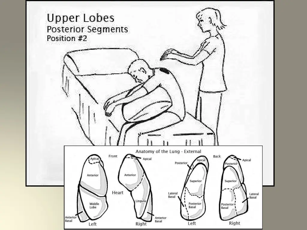 slide11