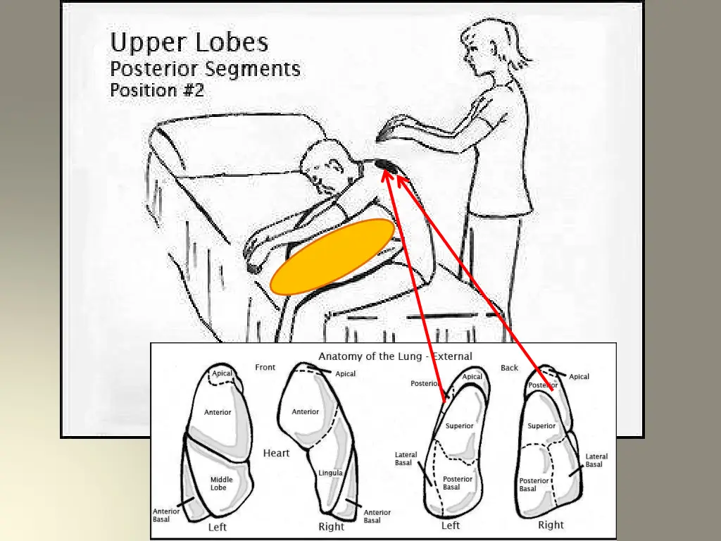 slide12