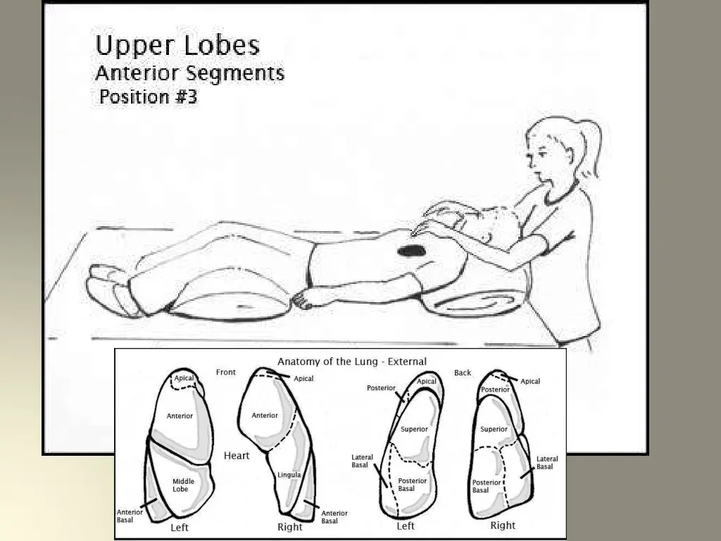 slide13