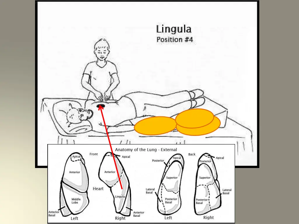 slide16