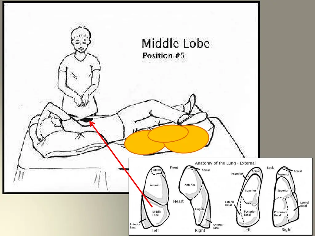 slide18