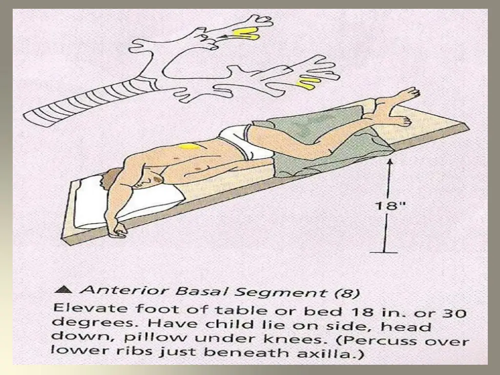 slide21