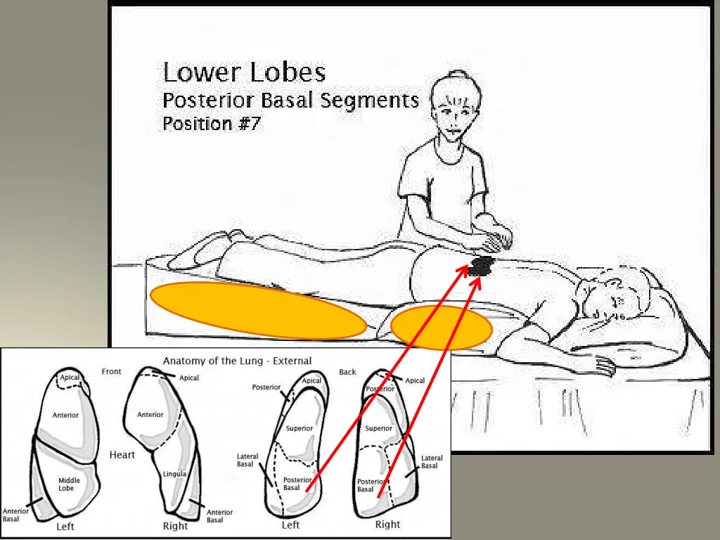 slide23