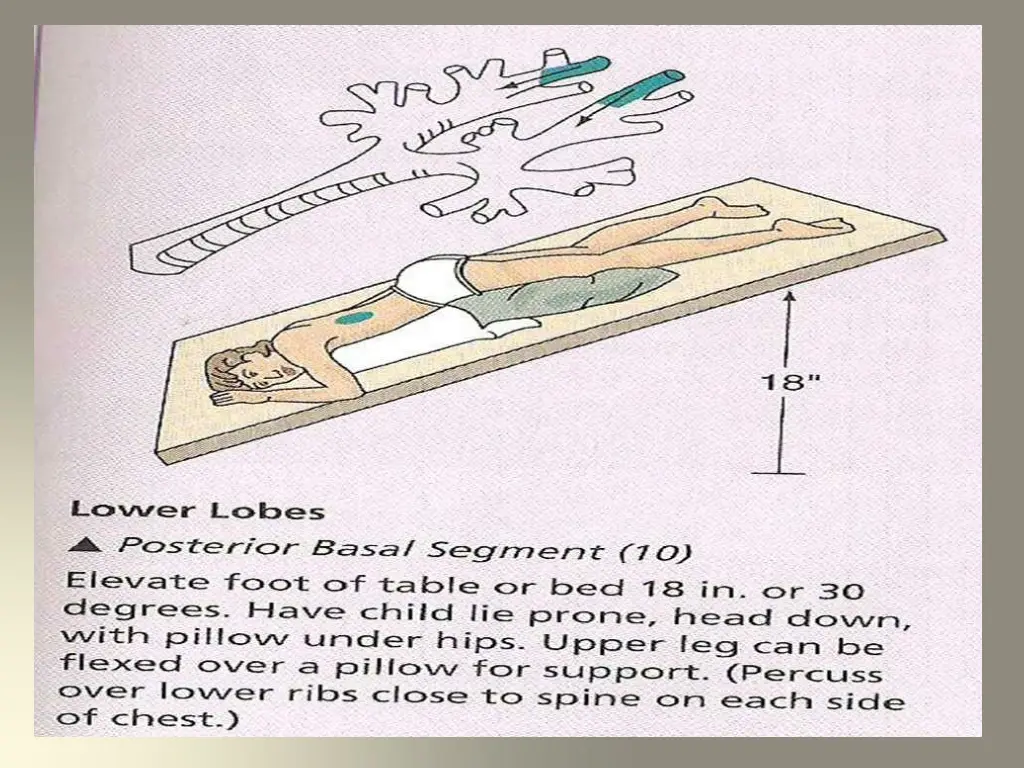 slide24