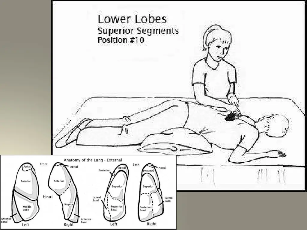 slide25