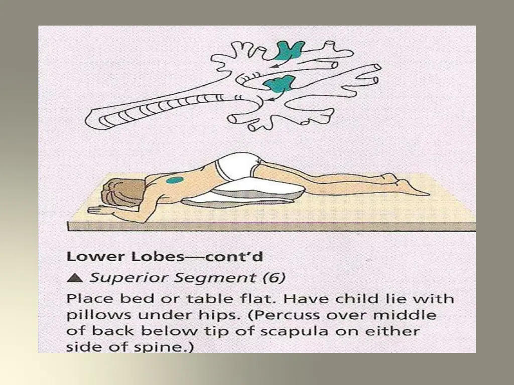 slide27