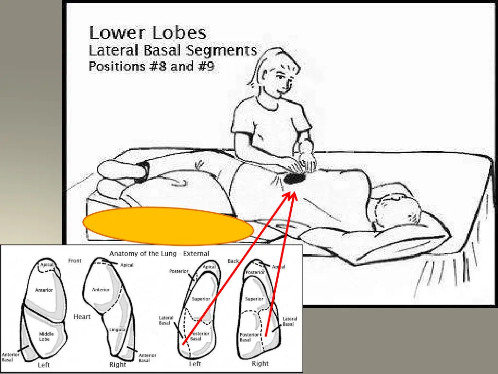 slide29