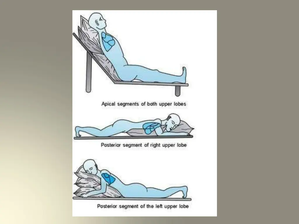 slide31