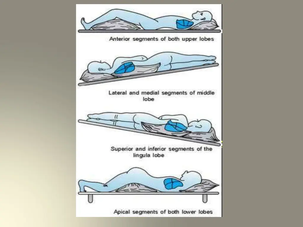 slide32
