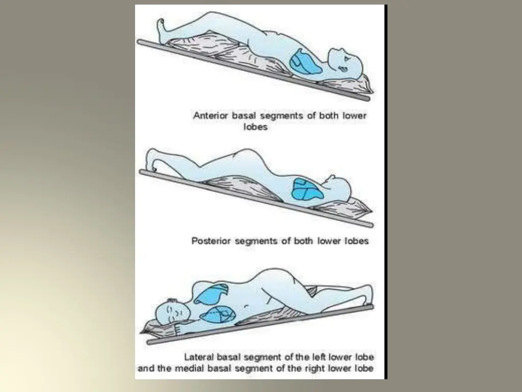 slide33