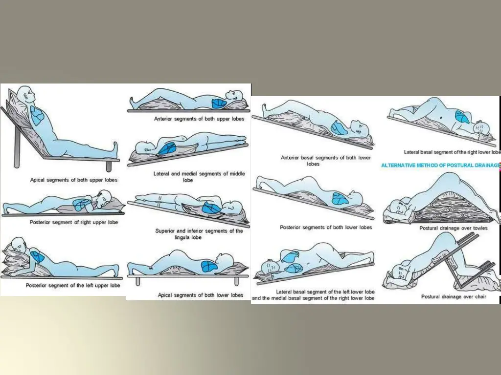slide35