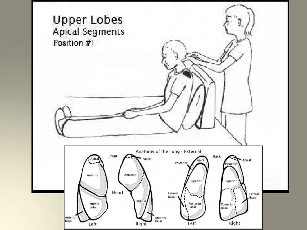 slide9