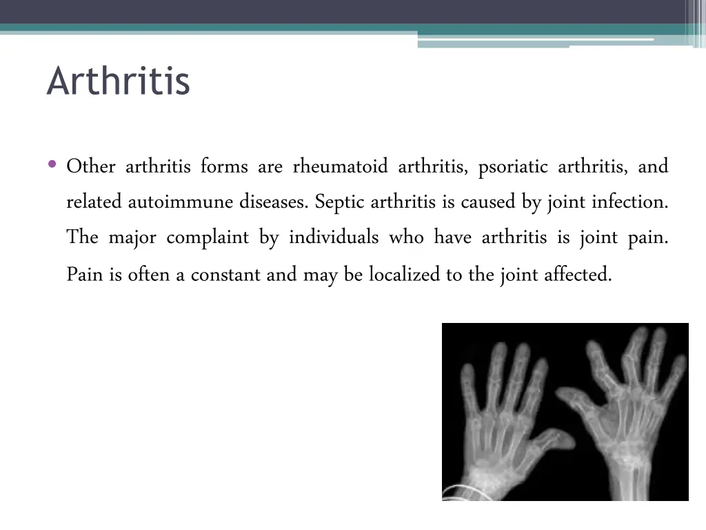 arthritis 1